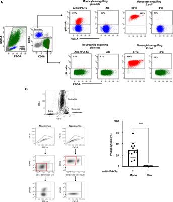 In vitro analysis of anti-HPA-1a dependent platelet phagocytosis and its inhibition using a new whole blood phagocytosis assay (WHOPPA)